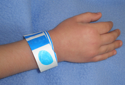 Figure 1. Color-Coded Wristband on a Pediatric Patient