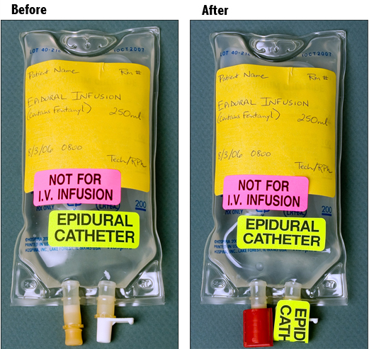 IV Access Ports