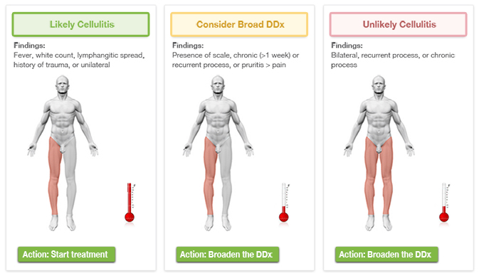 Triage Protocol for Red Skin (Suspected Cellulitis