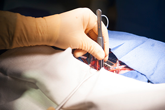 Closing the ventricular septal defect (a hole in the heart) in the mannequin as the field fills with blood. The team worked together to quickly correct the problem in order for the surgeon to close the hole.